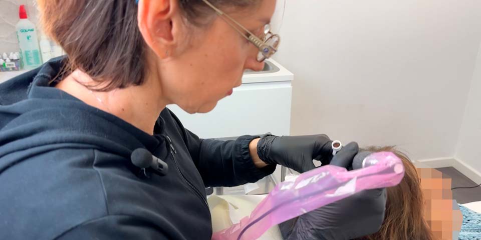 Trattamento estetico donna per diradamento dei capelli - Natalie Halova